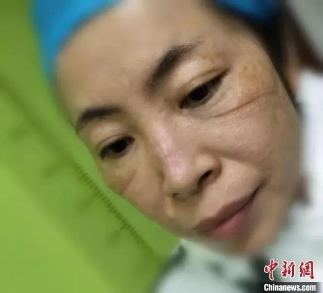  -jinnianhui | jinnian